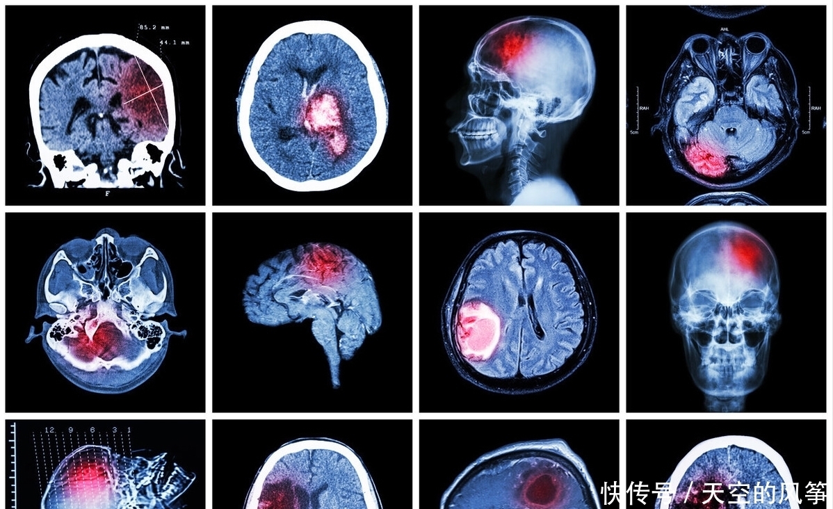 血压小于140/90就算正常?医生:6类高血压人,血压要求各不相同