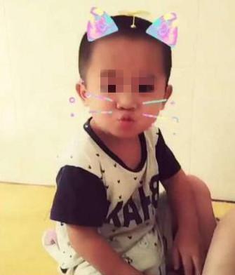 剪刀|5年前因吃奶太用力,被亲妈拿剪刀划破脸颊的男婴,现状如何?