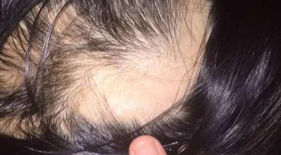 小心|你还“散头发”睡觉90%女生搞错了,小心变成“秃头女孩”