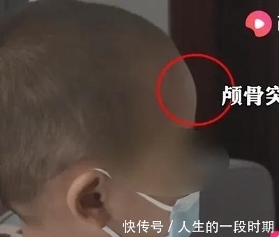 宝妈|触目惊心，江湖又现大头娃娃，无良商家，还能有点做人底线吗？