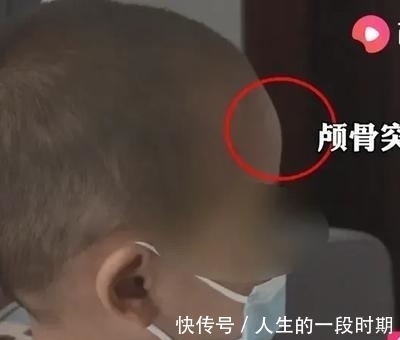 宝妈|触目惊心,江湖又现大头娃娃,无良商家,还能有点做人底线吗?