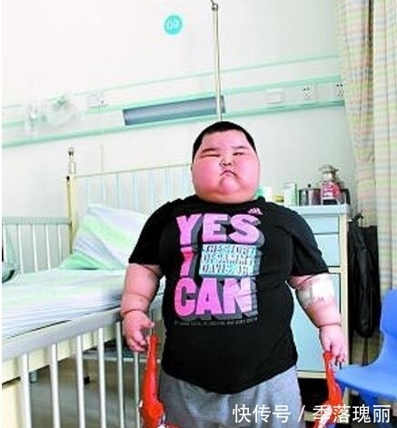 医生|3岁小男孩胖达120斤,智力超乎常人,医生的话让母亲难以接受