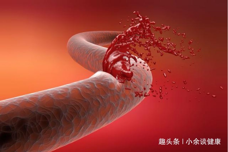 去世|48岁男子，深夜心梗去世，医生：睡觉时若有2种异常，尽早就医