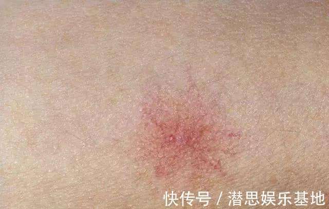 胆汁|肝脏有问题难发现,出现6种症状,你就要当心了