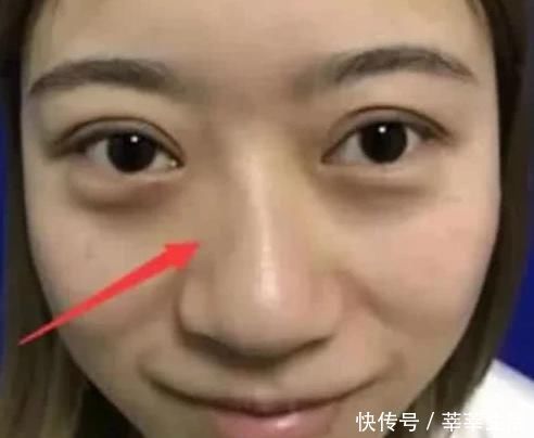 女生想拥有“婴儿鼻”,起床后坚持这3个习惯,或助你远离“草莓鼻”