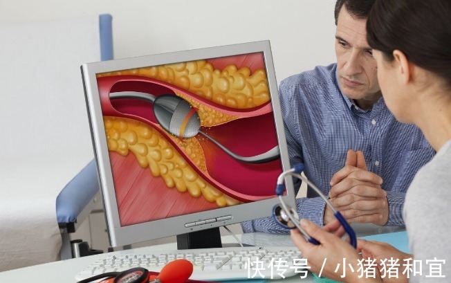 患病率|血脂升高,腿脚先知!腿脚出现4种“怪象”,提示你该降血脂了