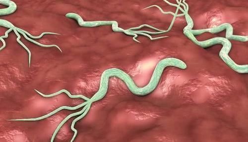 胃不好做好2事不吃2物,保护胃黏膜,或许幽门螺杆菌不来扰