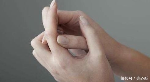 饮食习惯|老年痴呆经典测试图这张图中有一只猫,我猜你百分之百找不到