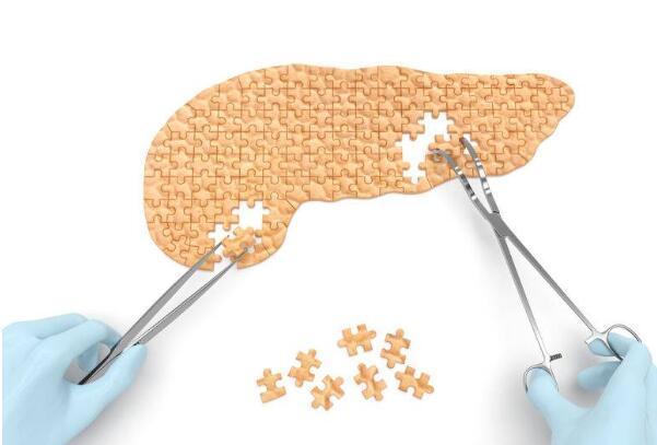 胰腺|胰腺癌不声不响医生这4个症状或是胰腺的“求救声”,要牢记