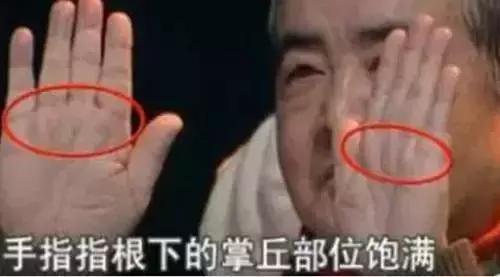 有没有|这条糖尿病线,你手上有没有如果看到它,请注意了