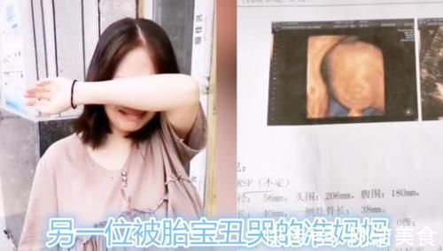 孕妈|孕妈看到胎宝“四维照”,表示娃不像自己,准爸爸:他也不像我!