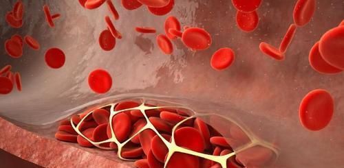 血管|血液黏稠的人,一定要多吃这6种食物,净化血液,血管更通畅