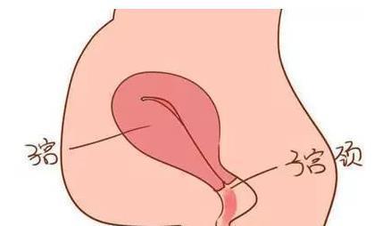 阴道出血|如果孕期发现这5种异常出血情况,立刻去医院!