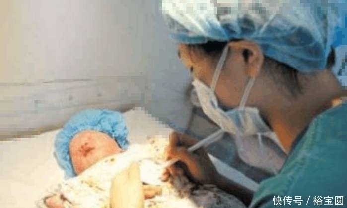 女子|女子怀孕每天吃一苹果,分娩时连医生都夸赞,女子:我很感谢婆婆