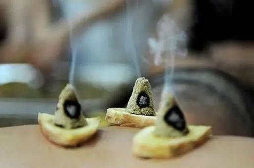 三伏灸|三伏天做三伏灸 能治哪些病?适合哪些人?【浦东医生话养生】