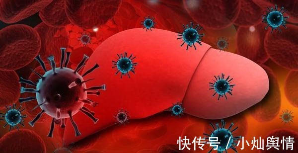 症状表现|乙肝癌变前，身体4个部位早知道，别不当回事