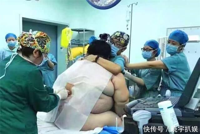 11胞胎|38岁产妇生下11胞胎,七儿四女,产前立下遗嘱先保孩子