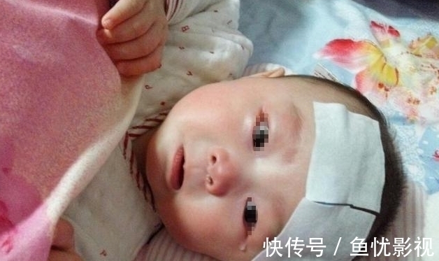 脾胃衰竭|8岁男童积食3年,拖成脾胃衰竭,医生:娃有5种表现,别再拖了