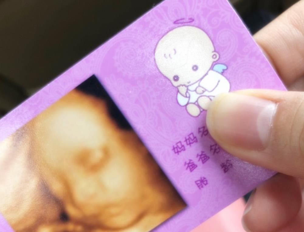 四维彩超|做四维彩超后,不做这步相当于“白花钱”,在检查前孕妈要问明白