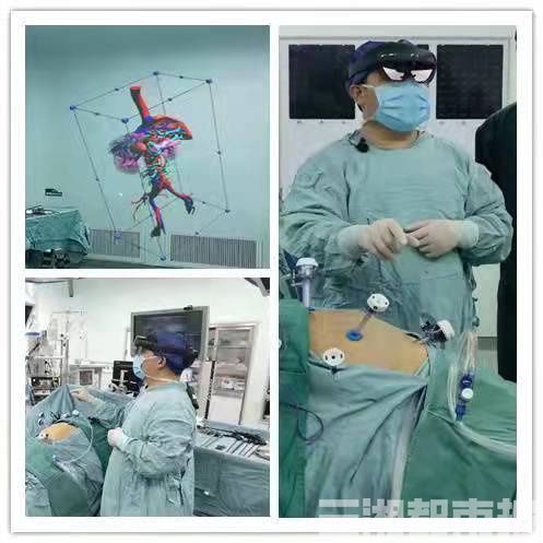 湖南省人民医院|运用VR切除肿瘤，黑科技”让医生有了“透视眼”