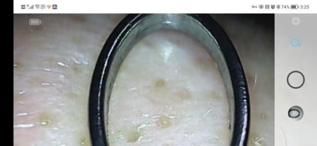 青春|洁净看得见,让青春轻松战“痘”: 媄拾智能可视毛孔清洁仪