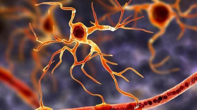 溶栓剂|食物“溶栓剂”公布了,早晚敞开吃,疏通血管,血栓或退避三舍