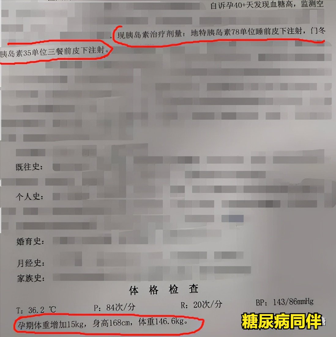 妊娠|一个妊娠糖尿病友的启示