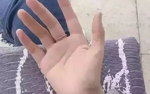 糖尿病患者|这个部位出汗,竟是中风前兆!(附最全出汗健康对照表)