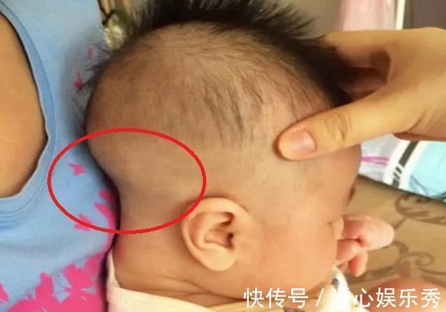 长时间|别让孩子用这三种姿势入睡,不仅影响头骨形状,大脑发育还会受限