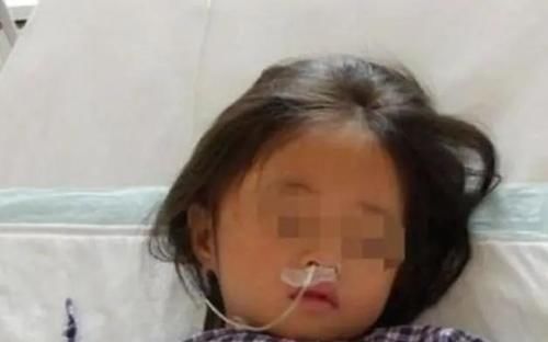 木质类|6岁女童得怪病突然暴瘦,检查后医生让摘项链,妈妈:哪里有项链