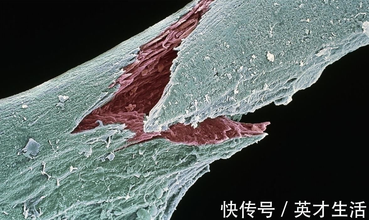 骨骼|109岁人，年轻仅65岁，长寿秘诀不是多锻炼，而是这3件事