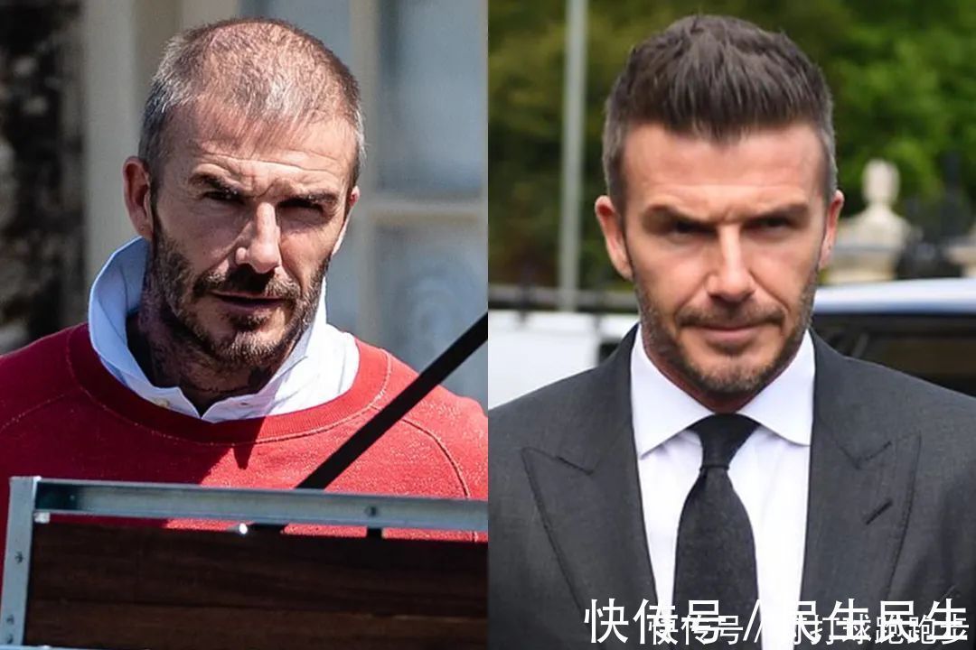 男士|45岁贝克汉姆也开始脱发了看来男士发量稀少,最好不要剪短发