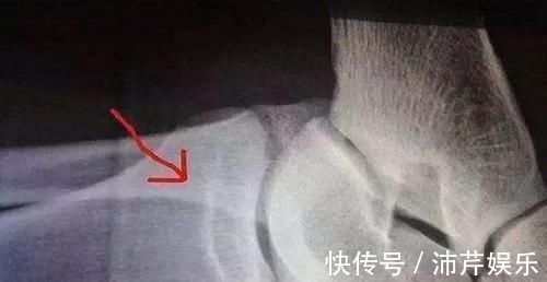 身材|想让孩子身材高挑,注意这两大“长个子”的征兆,轻松助力他长高