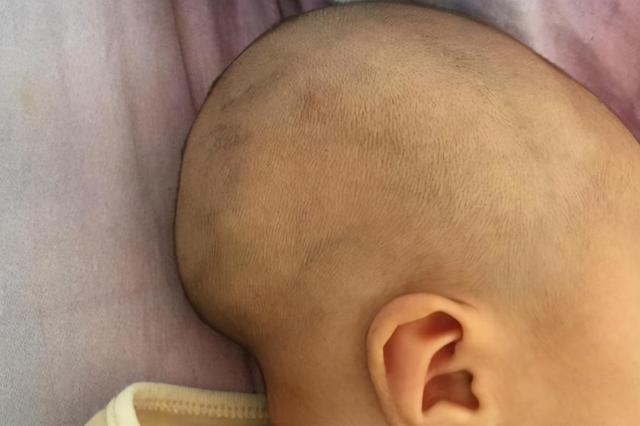 臭脸|“臭脸新生儿”走红网络,出生就带着怨气,网友:在娘胎里受气了