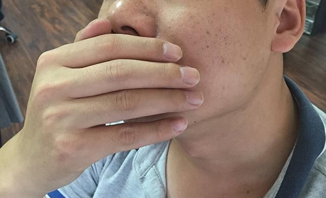 高手|天然溶栓高手现身,不是洋葱木耳,坚持吃点,血管通畅远离血栓