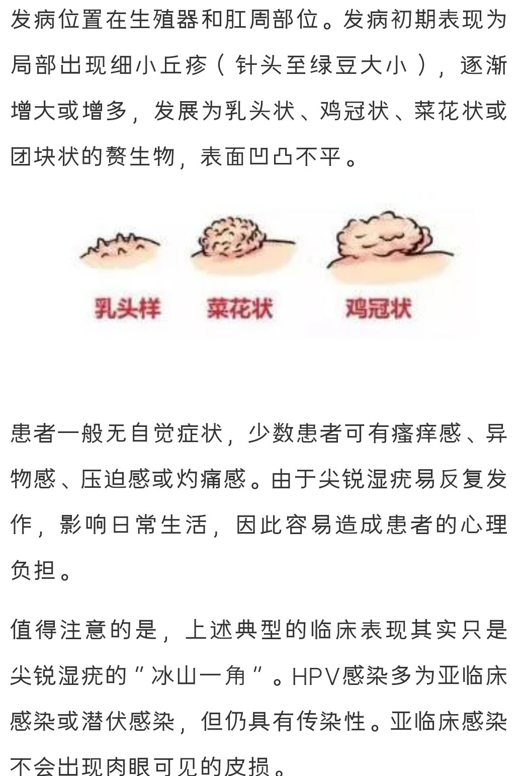  尖锐湿疣|【关注】除了宫颈癌，感染HPV还会导致这种疾病