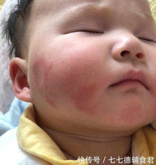 山药|医生直言：娃若积食，入秋后，“2红”要少吃，脾胃或会感谢你