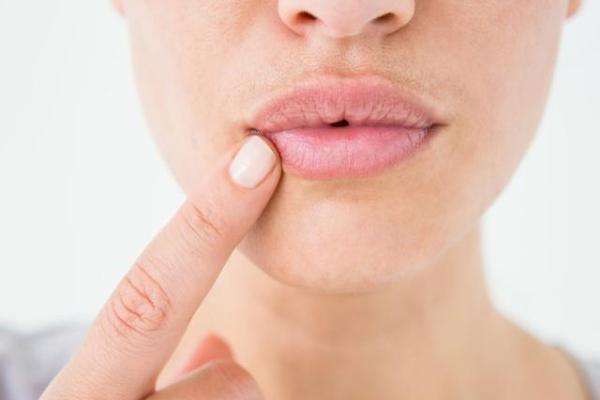 嘴巴|女人嘴巴上若有5个表现,多半是妇科病缠身,不妨了解下