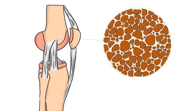 医生|人一老,骨头就松了?医生:不想被骨质疏松缠上,要多吃4样食物
