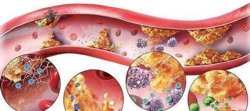 甘油三酯的“头号强敌”发现,没事喝两口,血管畅通,血栓绕道走