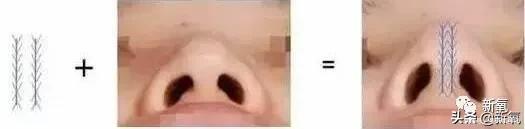 半个娱乐圈女明星脸上都有的这个坑，真的是线雕的锅吗？