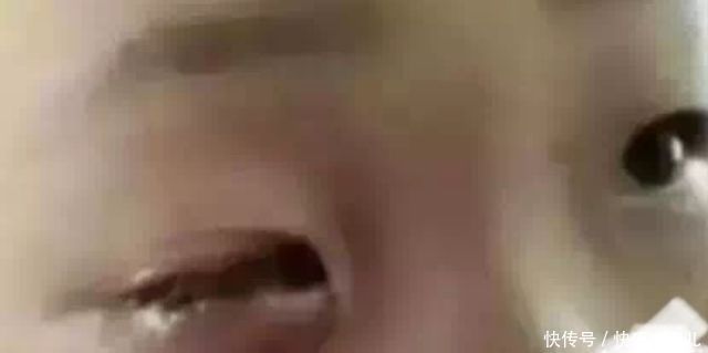 零部件|4个月宝宝双眼近乎失明,元凶很多家庭都有,家长别不在意