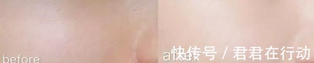 区别|“坚持美白”和“坚持补水”,10年后有什么区别原来差距这么大!