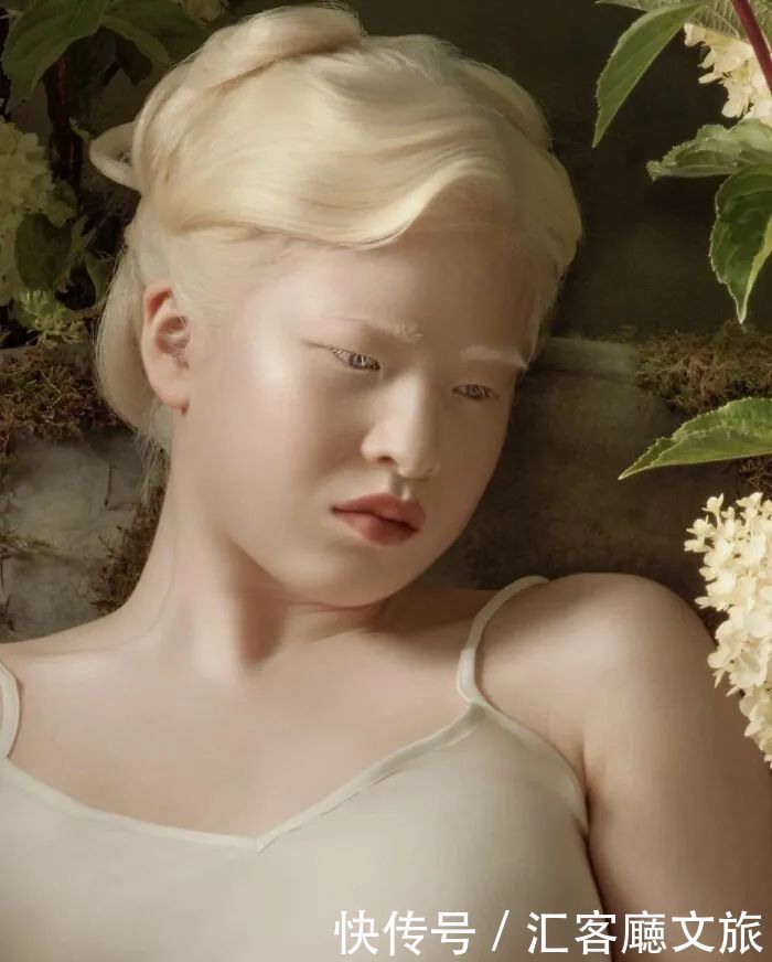 逆袭|因“全身雪白”被遗弃的中国女孩,逆袭成超模的故事让人泪目