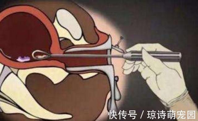 胎儿|孕妇被迫引产,腹中胎儿有感觉吗?看完这些画面,后悔得掩面痛哭