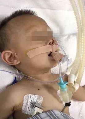 一个炒菜的功夫孩子就没了医生泣血忠告这些底线千万不要让孩子碰