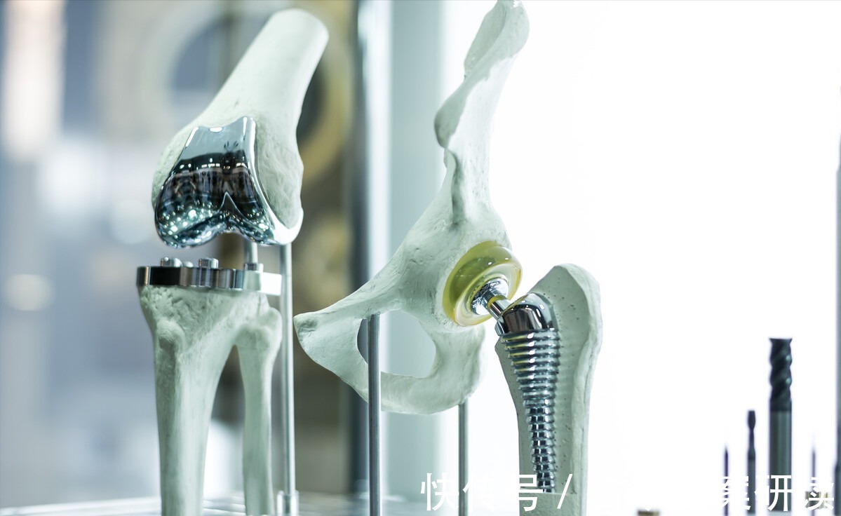 增生|七十岁老太太,右边膝盖痛1周,无法走路,医生:同种病也有轻重