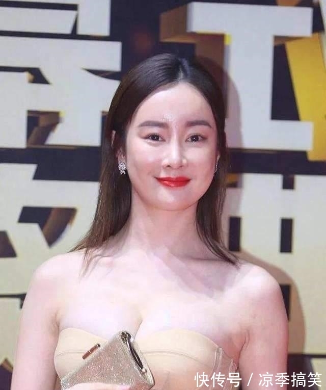 張檬|又是饅頭臉!婁藝瀟張檬孫菲菲,被玻尿酸害了的,還不止這些