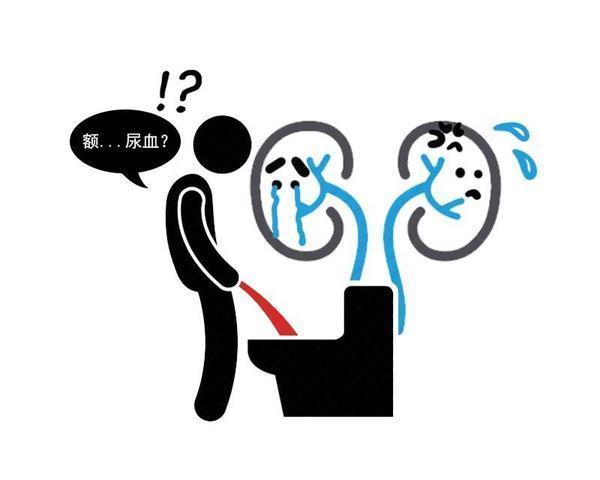 直系亲属|肾结石会找上门,或主要与这5个因素有关,了解后,及时调整