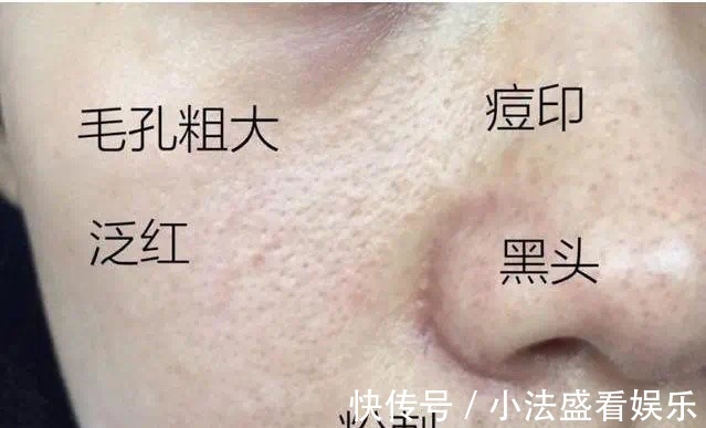 氨基酸洗面奶|把脸打湿,就上洗面奶?做不到“这几点”,别怪毛孔粗大易长痘